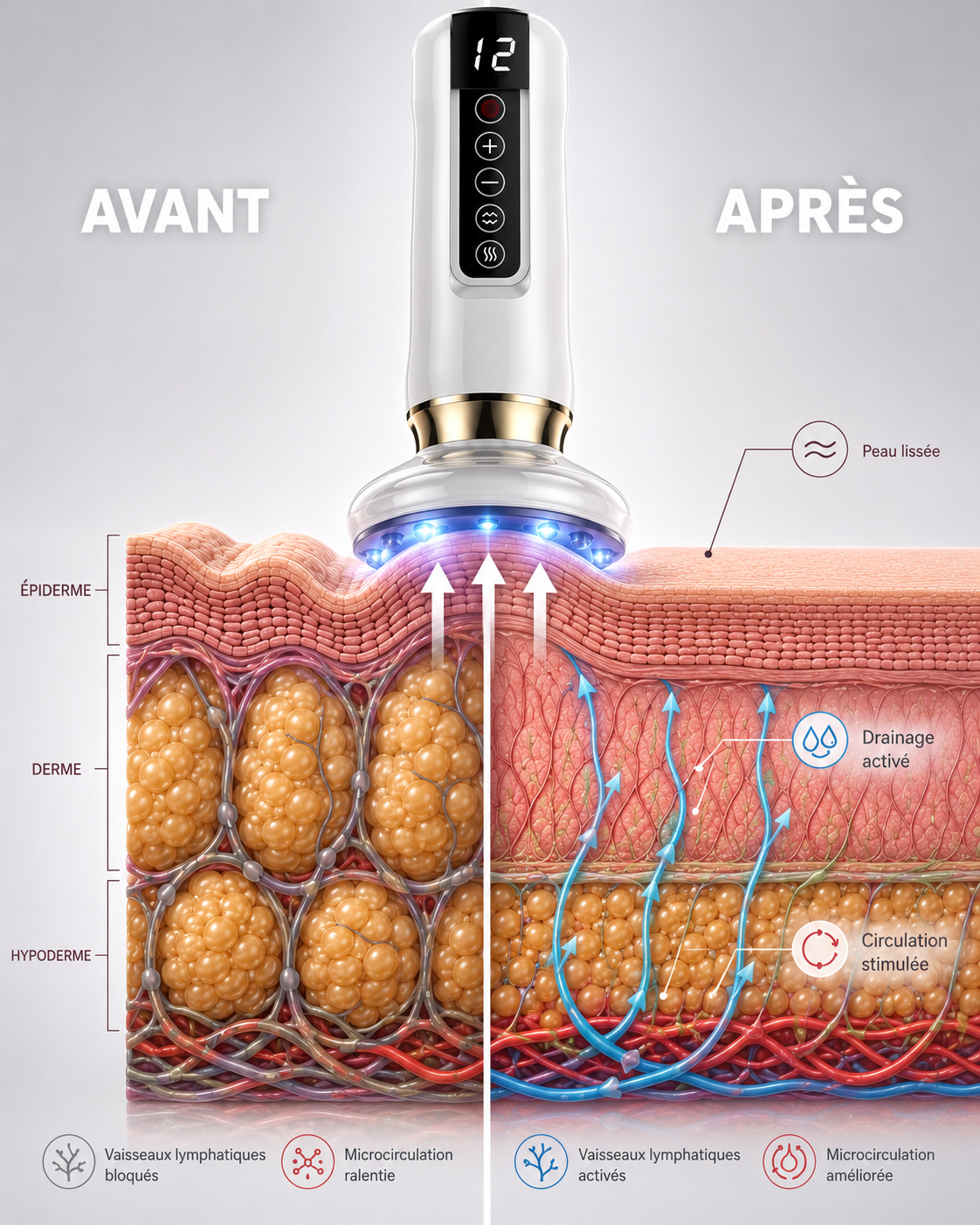 L'Onde - Masseur Anti-Cellulite Chauffant