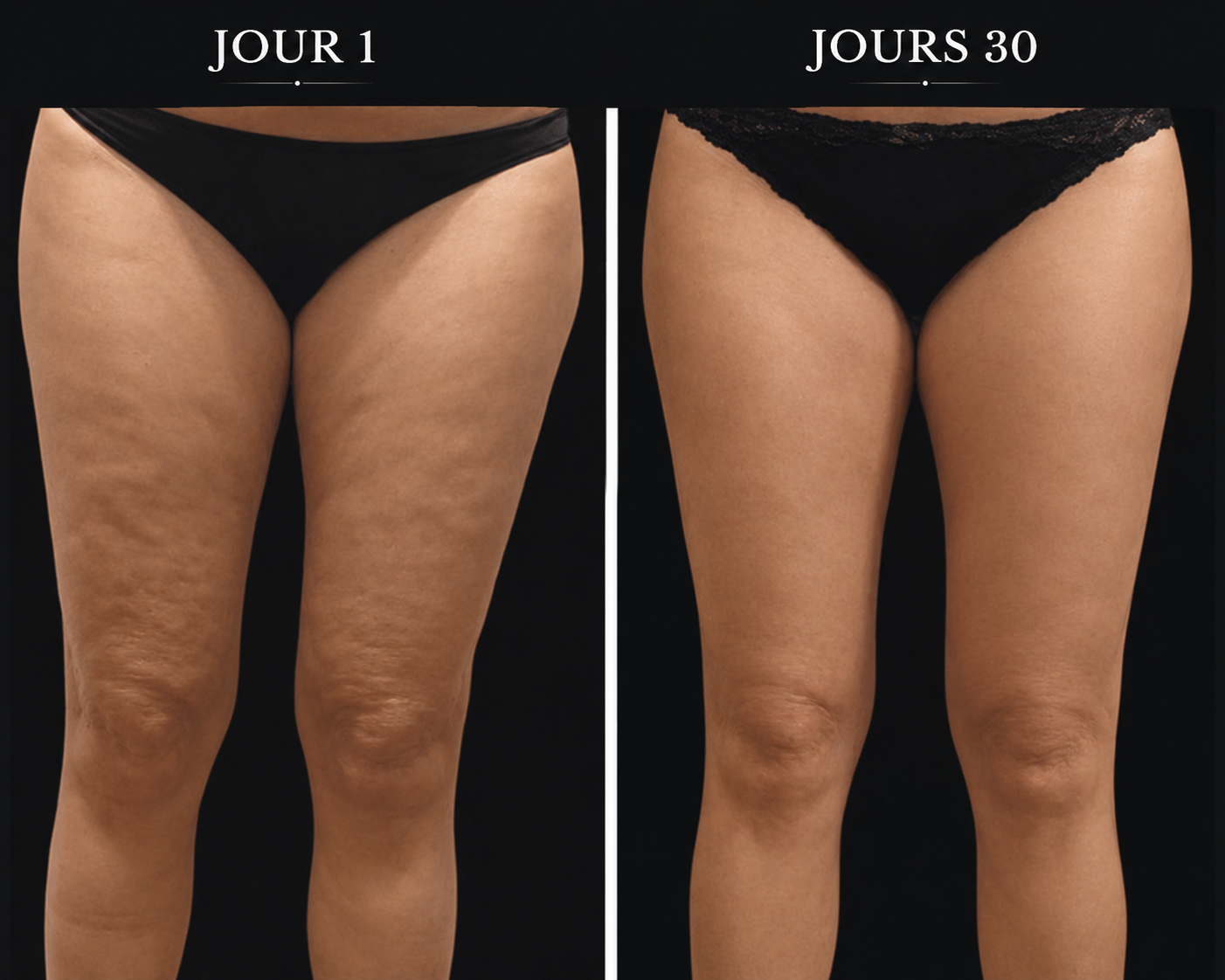 L'Onde - Masseur Anti-Cellulite Chauffant