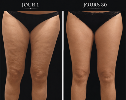 L'Onde - Masseur Anti-Cellulite Chauffant